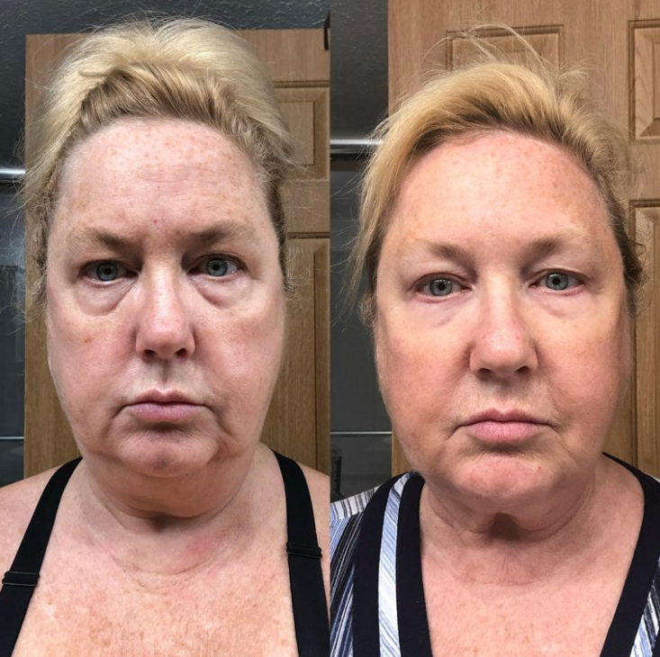 <h2>What Others are Saying?</h2>